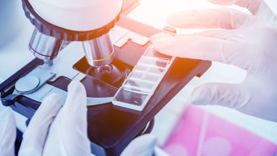 gloved hands and microscope - cancer research leads to new lymphoma treatment options